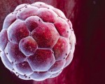 _67619413_p6800679-human_blastocyst-spl