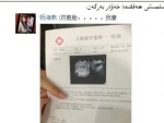 نىكاھسىز ھامىلدار بۇلۇپ قالغان قىز  توردىكى قىزىق نۇقتا بۇلۇپ قالدى  