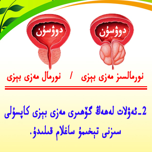 مەزى بېزى كاپسۇلى
